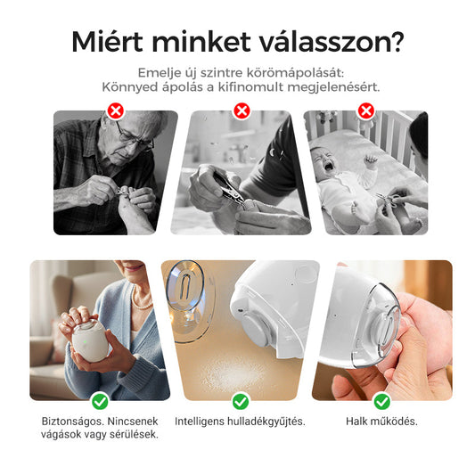 🎉1+1 ingyen🎉Univerzális automata körömreszelő felnőtteknek és gyermekeknek