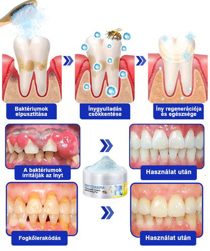🇭🇺 Furzero® 𝑭𝒐𝒄𝒖𝒔𝒔𝒎𝒊𝒍𝒆 – Méhméreges szájápoló por 🦷🦷🦷