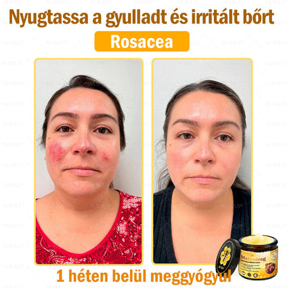 👍💪VLSVLS® Méhméreg Bőrhelyreállító Krém (👨‍⚕‍CE jóváhagyott)✅