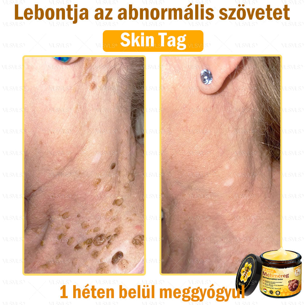 👍💪VLSVLS® Méhméreg Bőrhelyreállító Krém (👨‍⚕‍CE jóváhagyott)✅