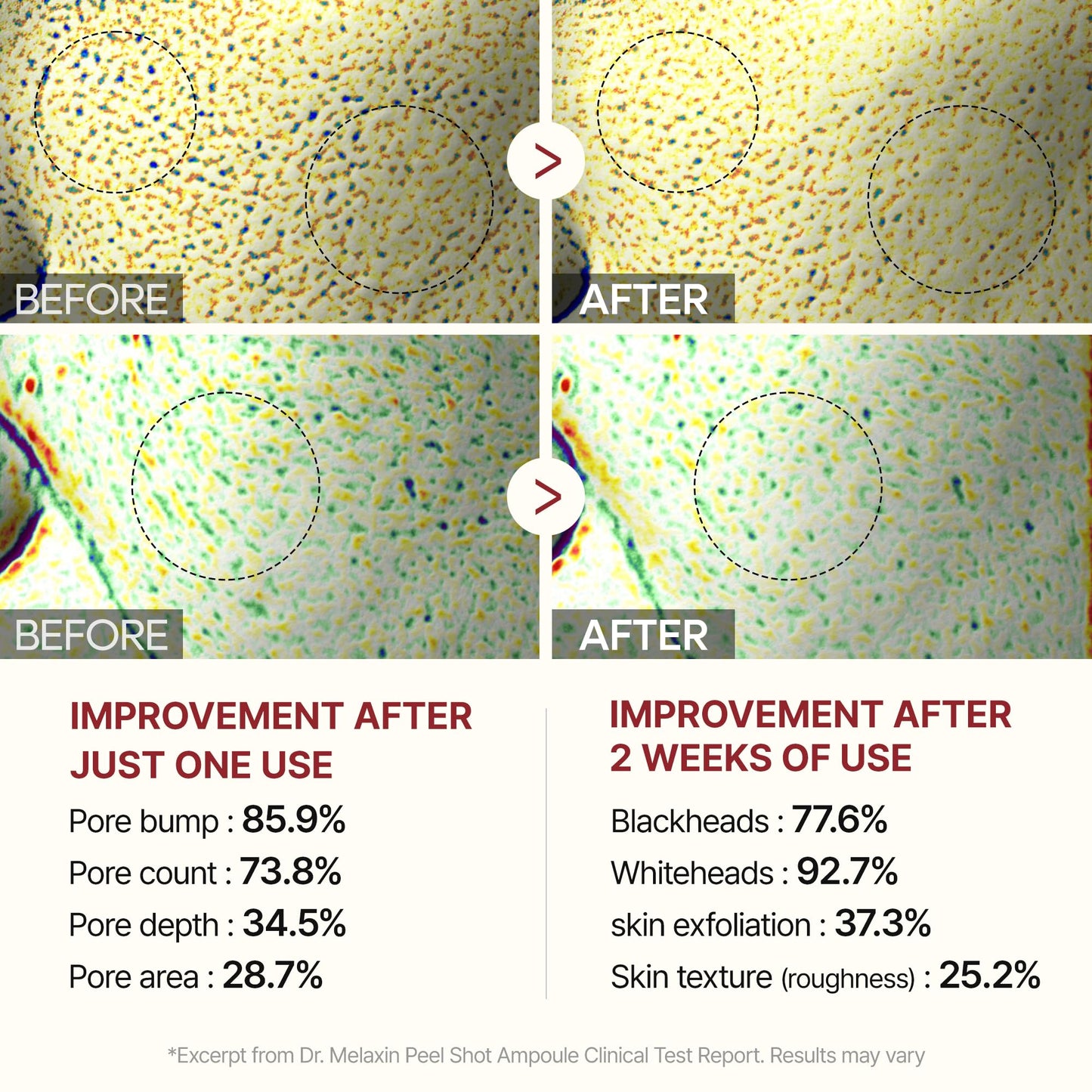 🌟Peel Shot Keratin Ápolás Kojic Sav Kurkuma Spray