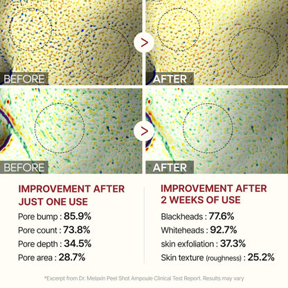 🌟Peel Shot Keratin Ápolás Kojic Sav Kurkuma Spray