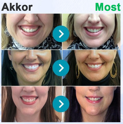 🇭🇺 Furzero® 𝑭𝒐𝒄𝒖𝒔𝒔𝒎𝒊𝒍𝒆 – Méhméreges szájápoló por 🦷🦷🦷