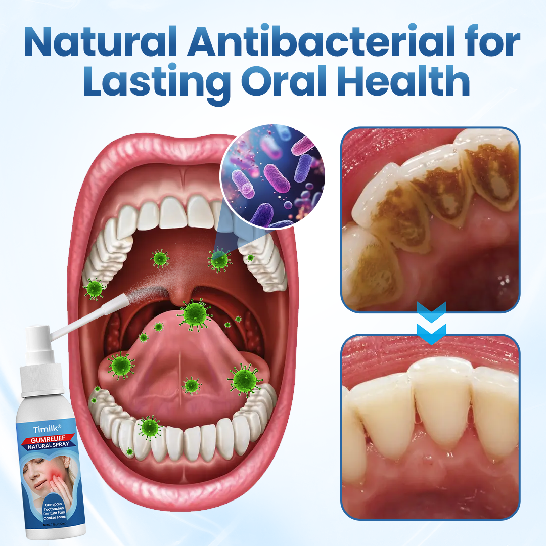 Természetes ínycsillapító spray