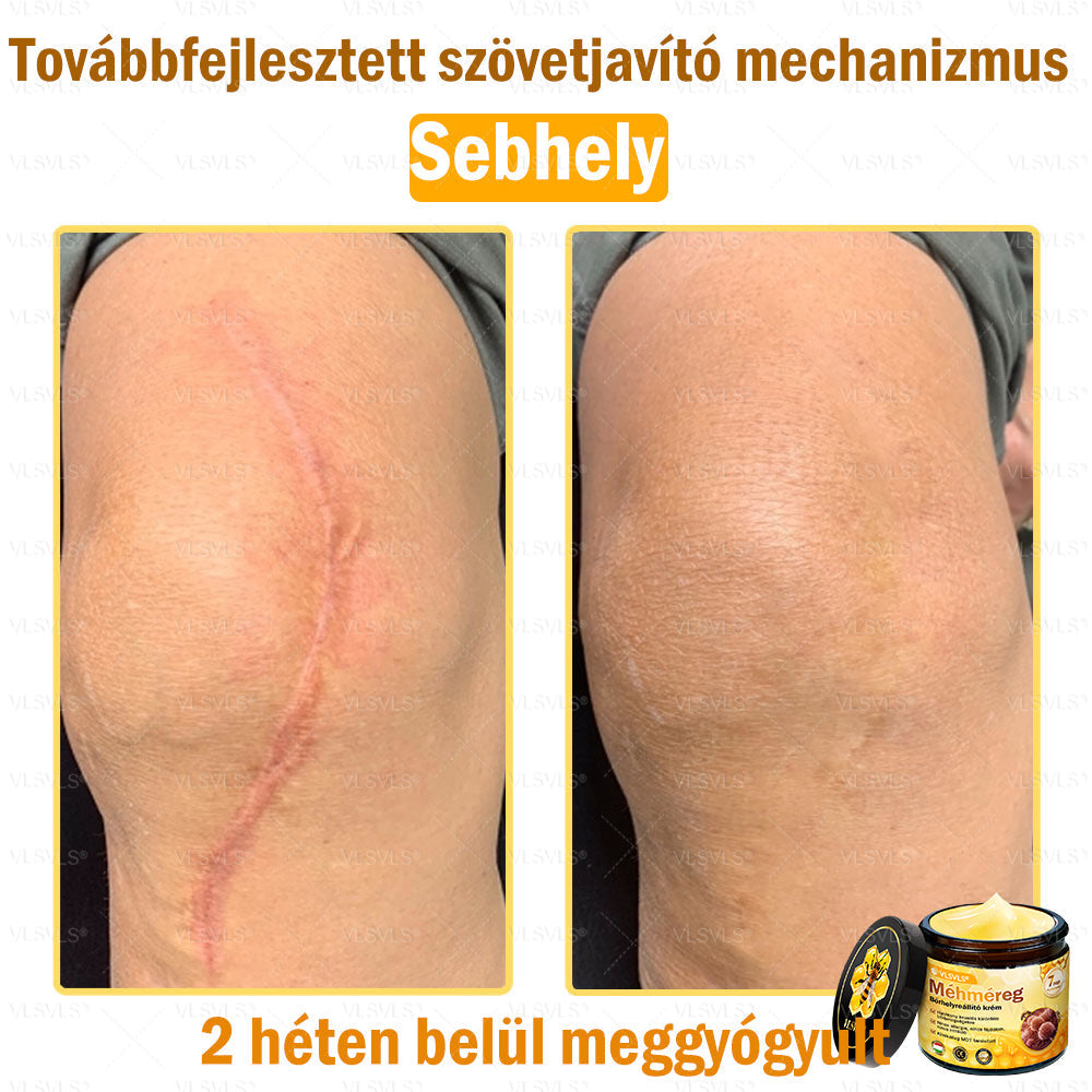 👍💪VLSVLS® Méhméreg Bőrhelyreállító Krém (👨‍⚕‍CE jóváhagyott)✅