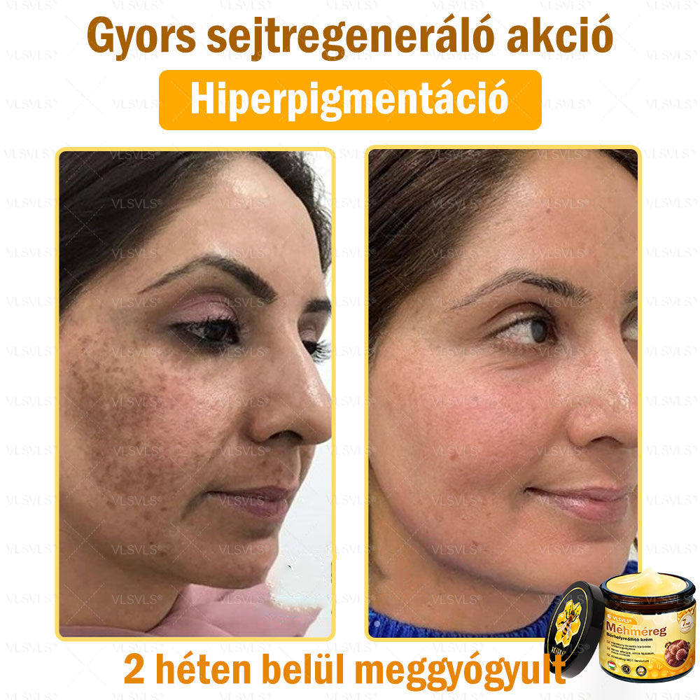 👍💪VLSVLS® Méhméreg Bőrhelyreállító Krém (👨‍⚕‍CE jóváhagyott)✅