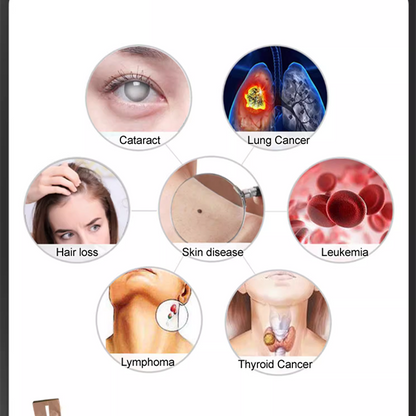 💧5 rétegű szűrős sugárcsaptelep víztisztító